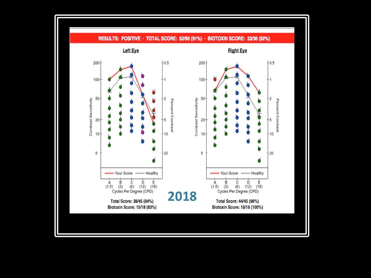 Mould+2018-1920w